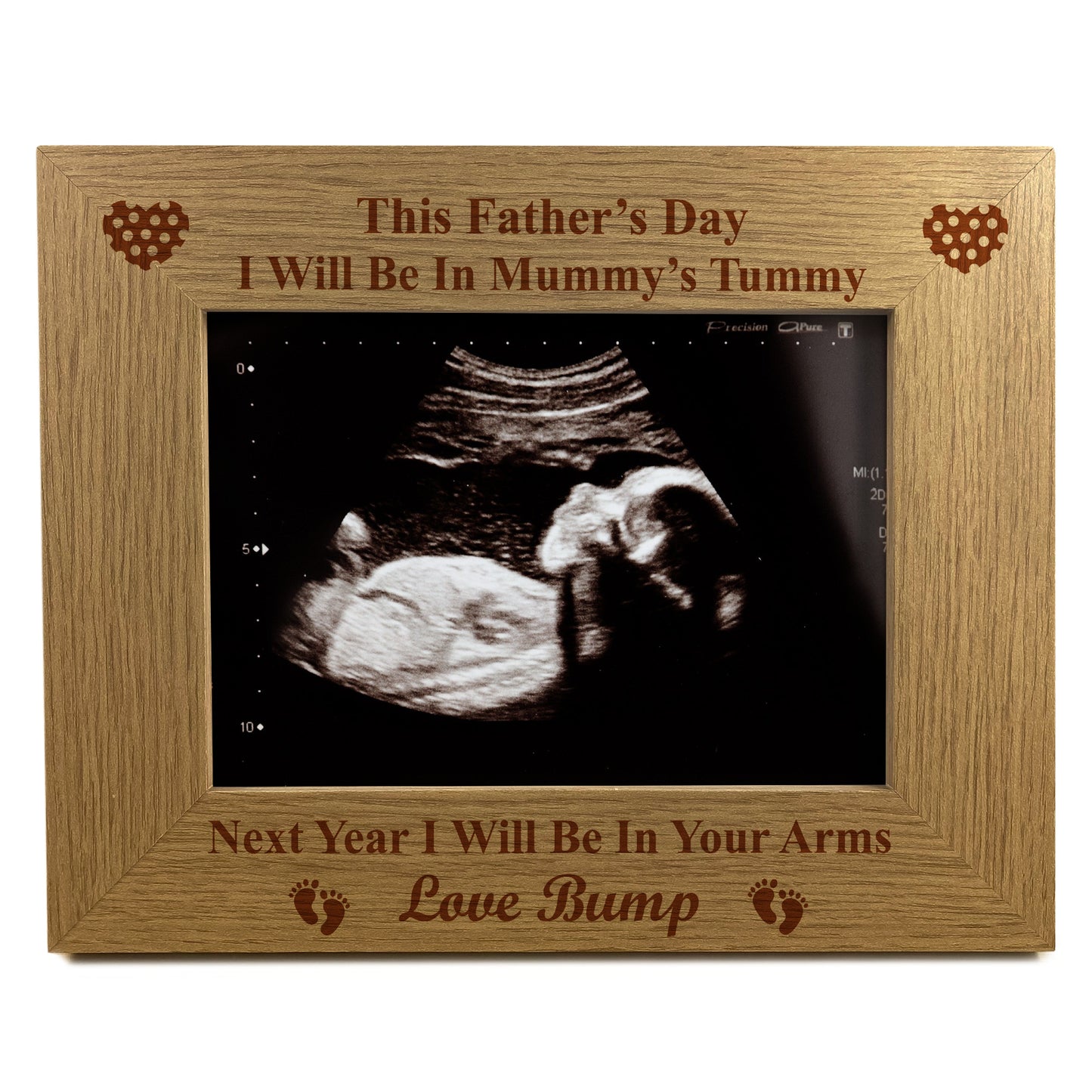 Fathers Day Gift For Daddy To Be Baby Scan Photo Frame Gift