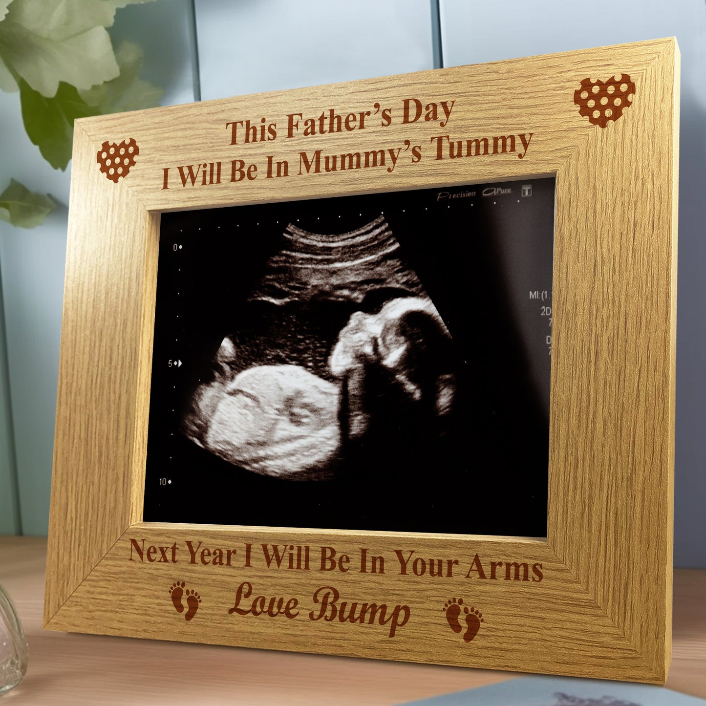 Fathers Day Gift For Daddy To Be Baby Scan Photo Frame Gift