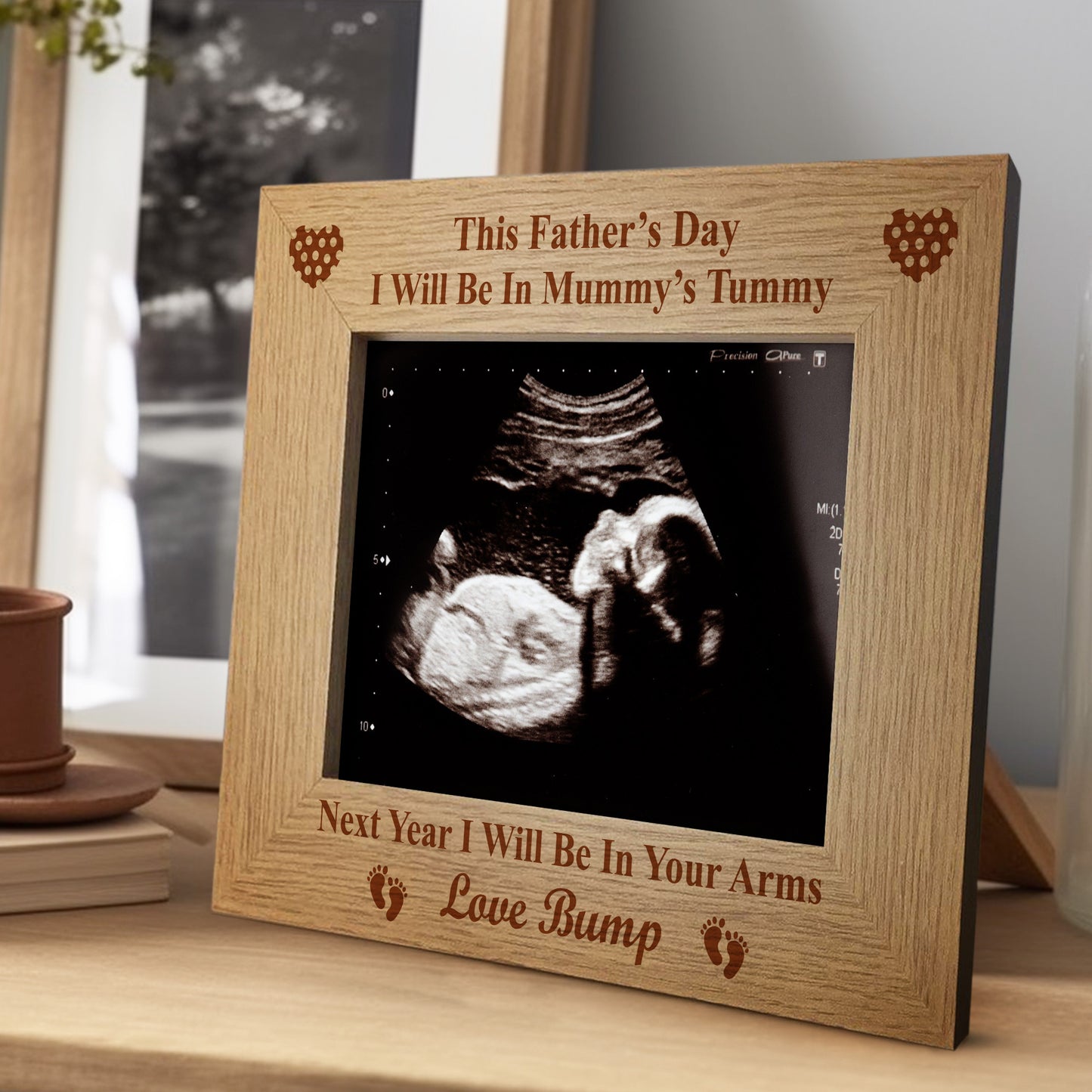 Fathers Day Gift For Daddy To Be Baby Scan Photo Frame Gift