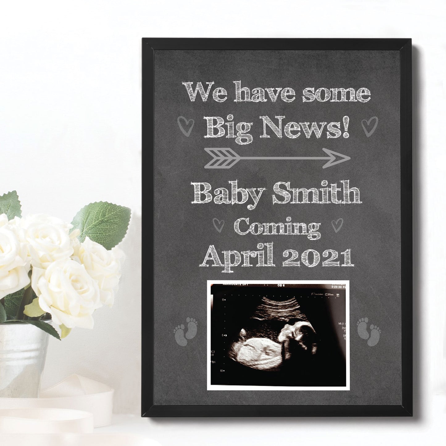 PERSONALISED Scan Image Framed Print Baby Announcement Gift