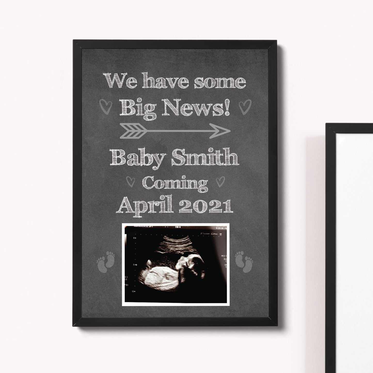 PERSONALISED Scan Image Framed Print Baby Announcement Gift